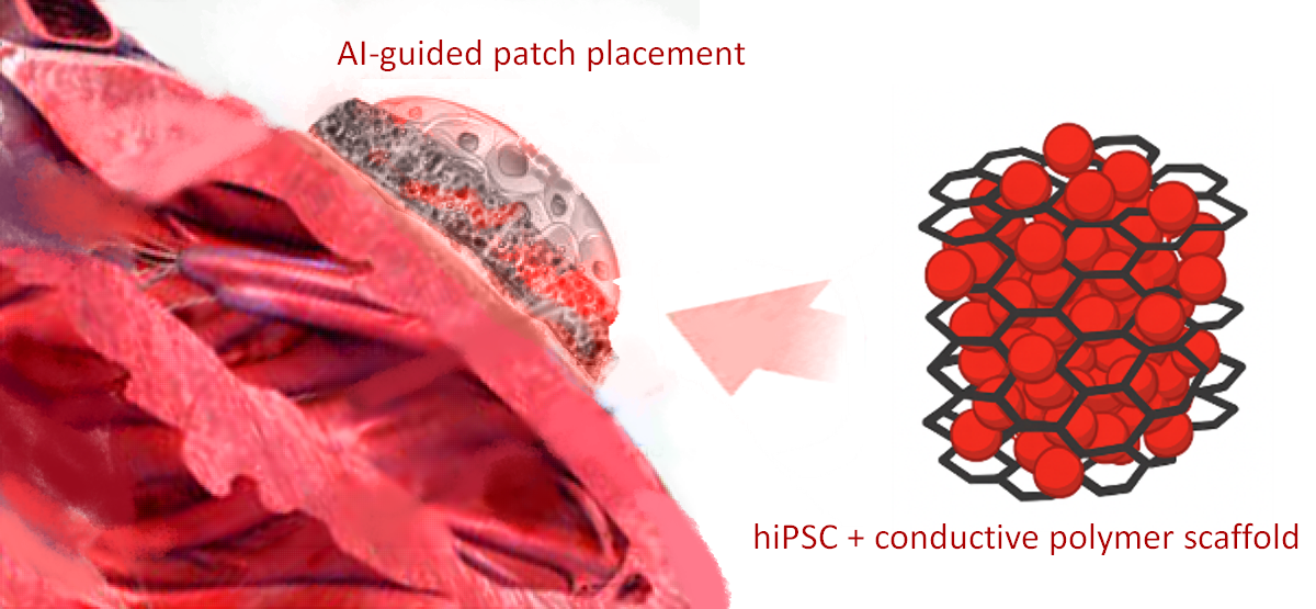 Cardiac Patch